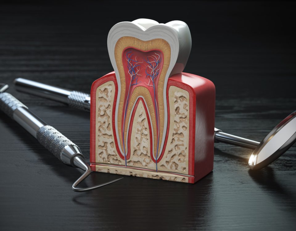 Tooth model cross section with dental tools on black wooden tabl